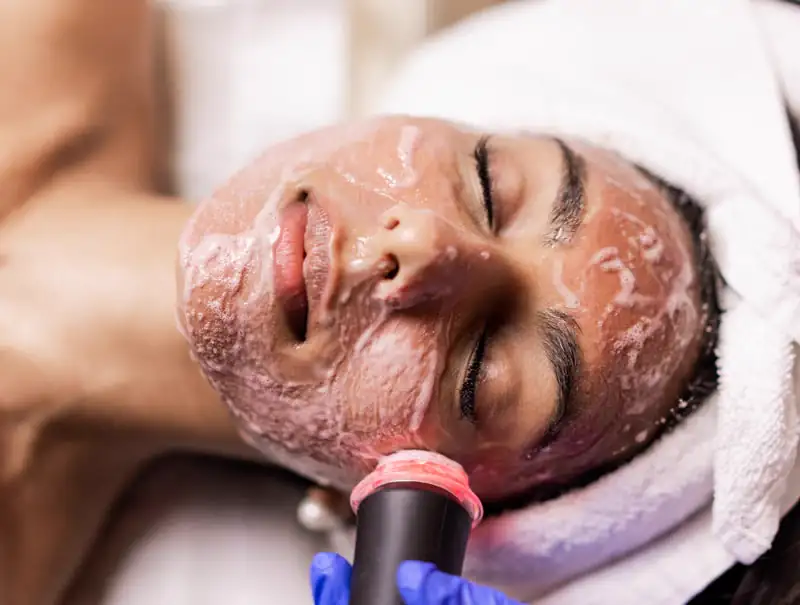 Oxygeneo IPL Laser Skin Rejuvenation